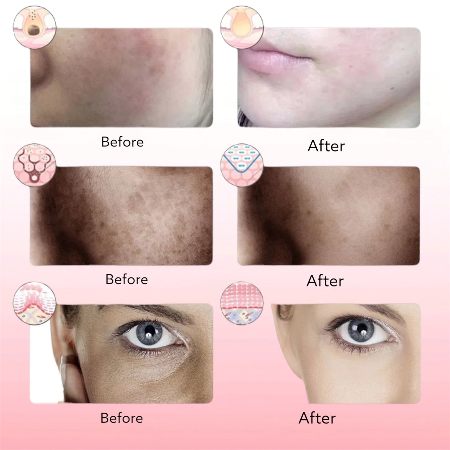 Blosshera™Photon Therapy Beauty Mask