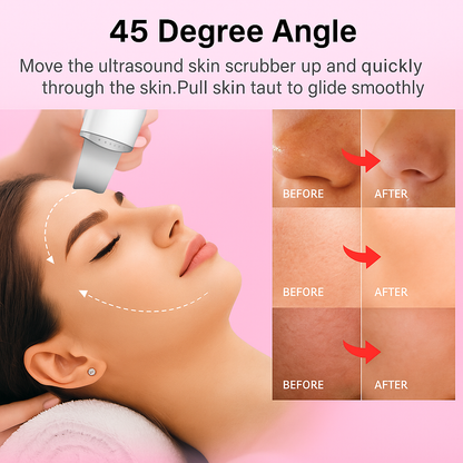 Blosshera™Ultrasonic Skin Care