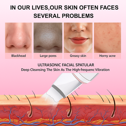 Blosshera™Ultrasonic Skin Care